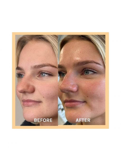 EVOLVE Evolve Miracle Vitamin C Mask - Image 13