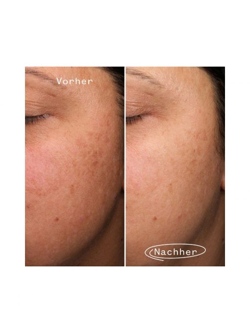 Pai Skincare Fade Forward Dark Spot Serum 30ml - Image 5